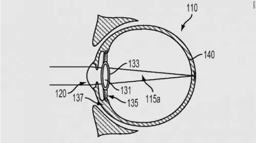 科技 | 谷歌把“電子眼注入眼球”，專利申請能否通過？